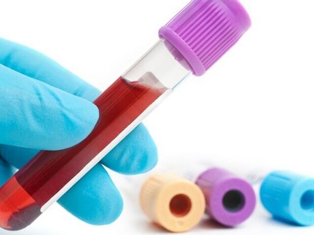 Laboratorní metody